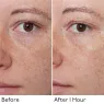 hyaluronic_global_face_cream_7_MBV9UdoBld.webp